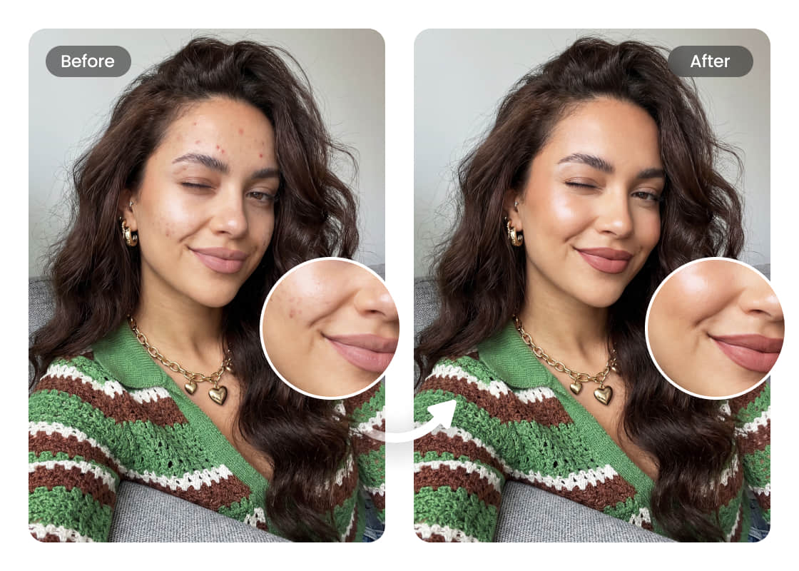 Удаление дефектов