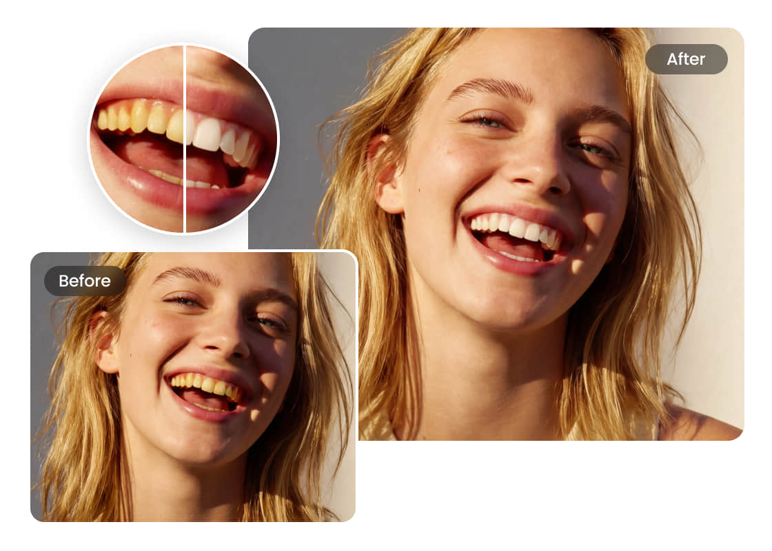 Отбеливание зубов