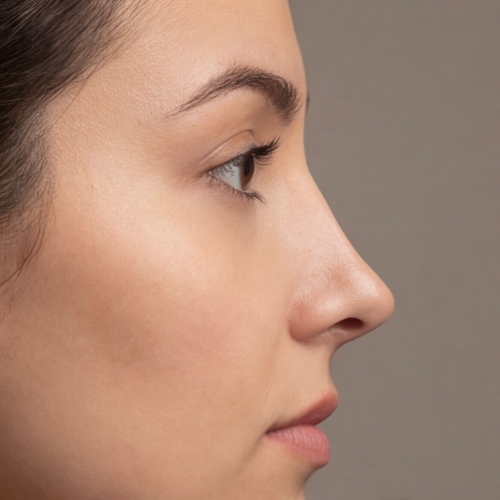 nose types - elf