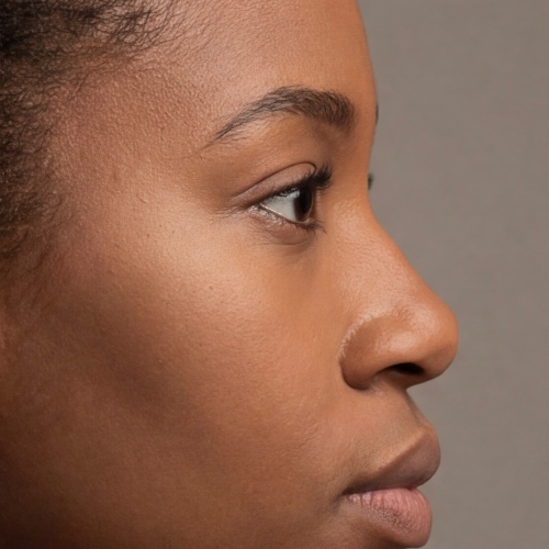 nose types - nubian
