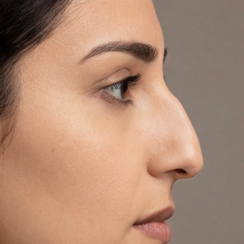 nose types - roman